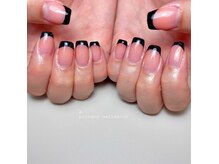 お爪の悩み解決します！