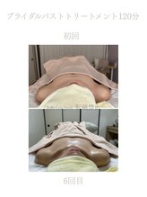 ハリムーン 仙台(harimoon)/バスト・ブライダル