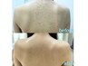 【背中上or下】繰り返す背中ニキビ改善ケア