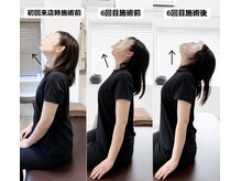 ジェイミープラス 表参道(J‘aimee +)/首・頭痛改善のビフォーアフター