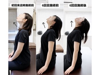 ジェイミープラス 表参道(J‘aimee +)/首・頭痛改善のビフォーアフター