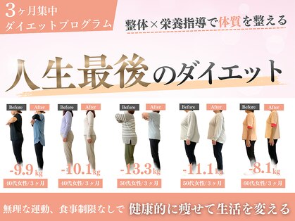 カイト(Kaito)の写真