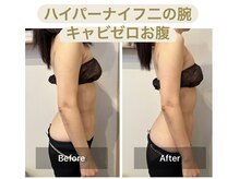 ビボーン ボディ(美bone body)/ハイパーナイフ×キャビゼロ