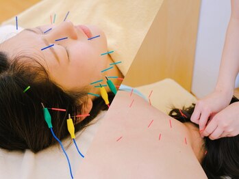 さかきばら健美鍼灸院の写真/《鍼灸・あん摩マッサージ指圧師(国家資格者)》のみによる施術をご案内♪辛い箇所、お悩みを根本から改善◎