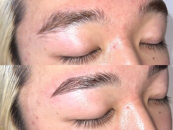 キャンバス 初台(CANVAS)/- Men's HBL - Before/After