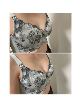 エミニナル(EMININAL)/【バストケア】ビフォーアフター