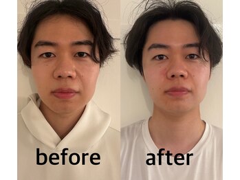 マホロバ(mahoroba)/美容鍼+EMS