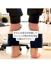 はやと整体院/６０代女性（親指の変形）