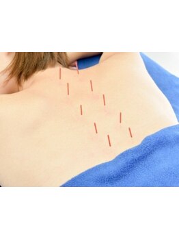 接骨院・整骨院で施術を受けたい