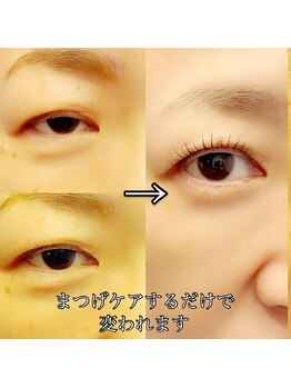 グロウビューティー(grow beauty)/