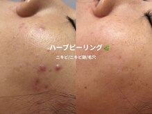 ピブ(pib.)/本当に変わるんです！