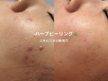 ピブ(pib.)/本当に変わるんです！