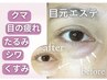 くま、たるみ、小ジワ、浮腫、眼精疲労改善!アイパワーエステ8800円→6600円