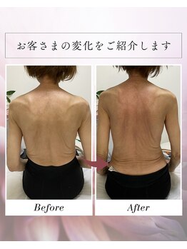 ナオフクオカ ヒーリングフォースエヌ(NaoFukuoka/healingforceN)/背中の痛みや腰痛にも！