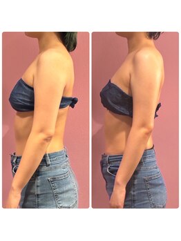 ククナ 上越店(KUKUNA)の写真/首・肩こり、巻き肩、反り腰でお悩みの方に。