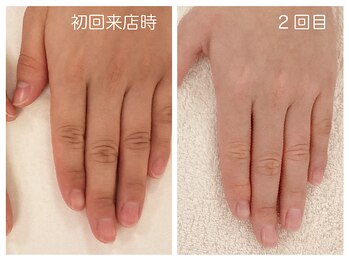 キレイテ 上野店/30代/2回目【東京ハンドケア】