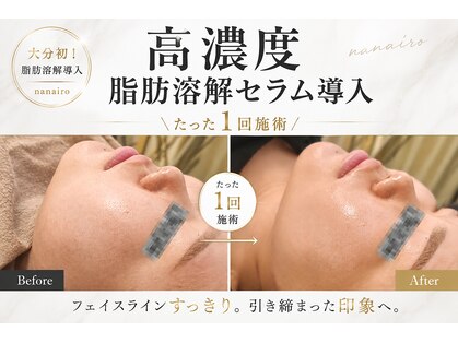 ナナイロ(nanairo)の写真