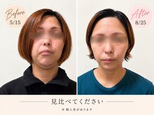 ヨサパーク ピオニー 二日市店(YOSA PARK Peony)の雰囲気（【人気No.1プレミアム90分】まずはフェイスラインから♪）