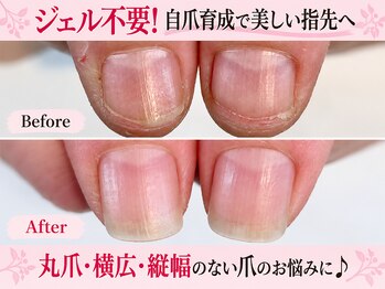 ココデネイル 南区大橋(cocode nail)の写真/【ジェル不要の自爪育成】丸爪・縦幅のなさ・爪の形のお悩みに！隠す手元から見せたくなる美しい指先へ♪