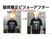 やち鍼灸院/猫背矯正で姿勢美人に！