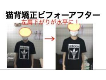 やち鍼灸院/猫背矯正で姿勢美人に！