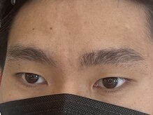 ビューティーガーデン イース/BEFORE