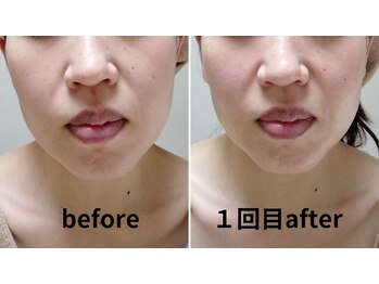 心音/全体にキュッと引き締まり小顔に