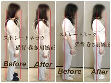 ティーエスエル とがし整体ラボ(TSL とがし整体 Labo)の雰囲気（首肩こり ストレートネックは姿勢矯正でTOTAL CARE！猫背 巻き肩）