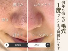 レイビューティー 一宮店(RAY+ Beauty)