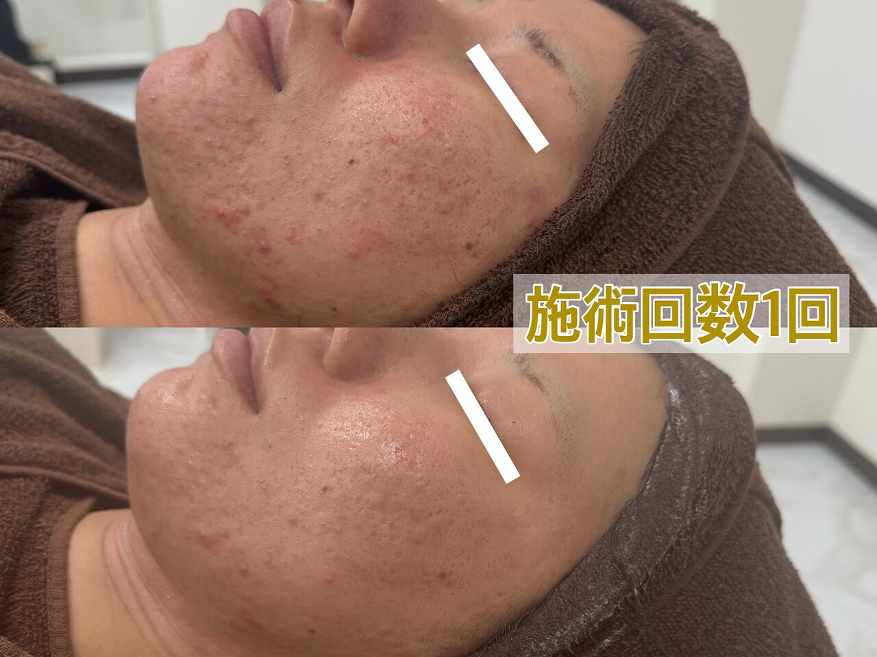 肌質改善エステサロン♡ テンニック(10nick)｜ホットペッパービューティー