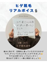 ブロウブロウ(Blow Brow)/ヒゲ脱毛