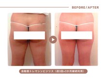 イエス マイサロン(yes My Salon)/自動筋トレマシンBIJIRIS施術例