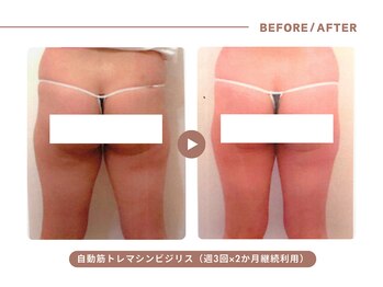 イエス マイサロン(yes My Salon)/自動筋トレマシンBIJIRIS施術例