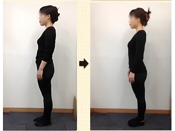 なぎ整体院の写真/小尻になりたい・体型を変えたい！体の骨格を調整することで体型を変える★年齢を重ねても綺麗になれる！