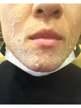 ザ グロウム(The glowm)/ハーブピーリング