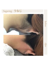 エムケーサロン(Mksalon)/シュガーリング脱毛/うなじ