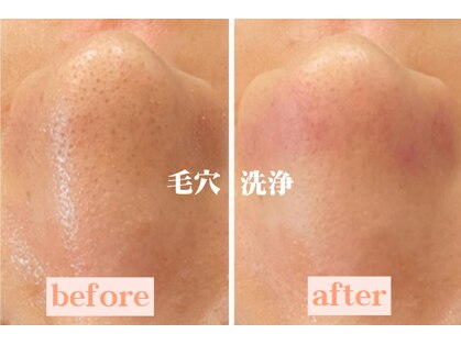 ベベ もりの里店(Be'be')の写真