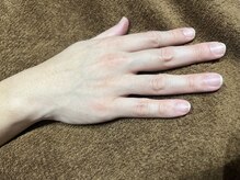 ヴィプラス(VIPLUZ)/見える手の甲もスッキリ☆