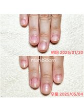 マニブルーム/深爪矯正