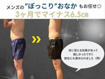 ウナ 福岡店(UNA)/メンズの浮き輪肉も☆-6.5ｃｍ