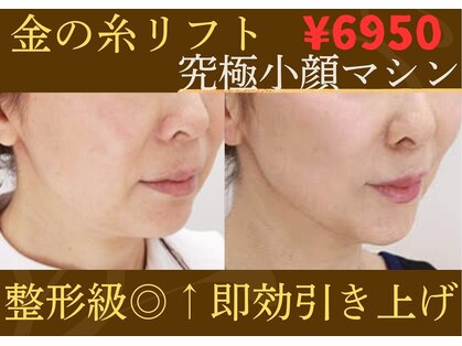 ムーンライズ(moonrise)の写真