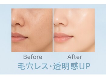 エムアイ 六本木(Mi)/水光ピール