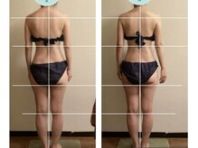 筋膜リリースは集中5回で身体リセット！後ろ姿の変化が別人級