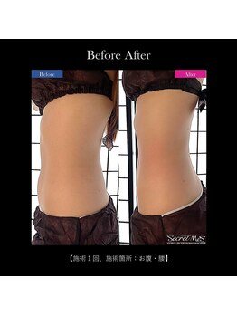 アルビ(ARuBi)/【キツイ運動は卒業】脂肪燃焼◎