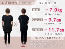整体院ルーツケア/50代 3ヵ月ダイエット(痩身)成果