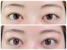 トータルビューティ ノイド(Noid)/パリジェンヌ＆眉WAX脱毛