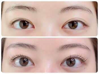 トータルビューティ ノイド(Noid)/パリジェンヌ＆眉WAX脱毛