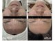 グロウラ(GrowRa)の写真