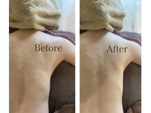 キコ リラクゼーションサロン(KICO by PLUS)/灼熱の神泡体験 