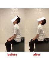 ナオル整体 福岡香椎院(NAORU整体)/20代男性施術事例【首肩こり】